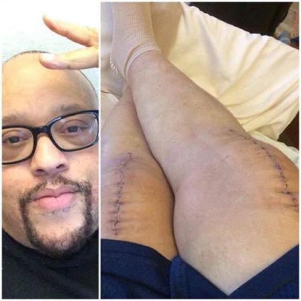 fred hammond surgery